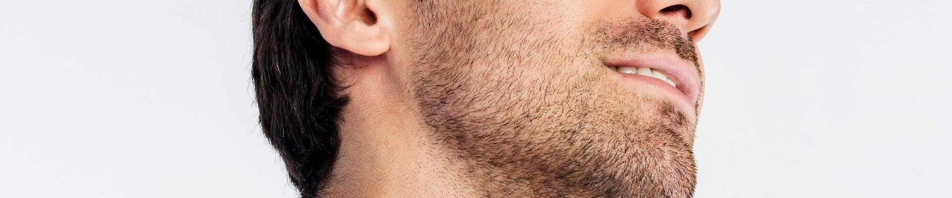 beard-transplantation