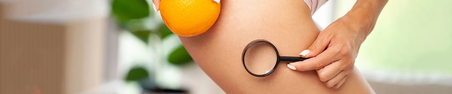 cellulite-treatment