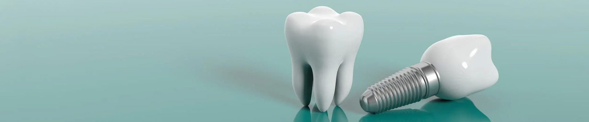 dental-implants