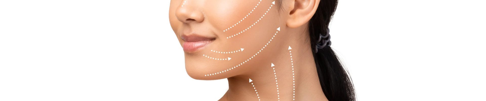 face-lifting