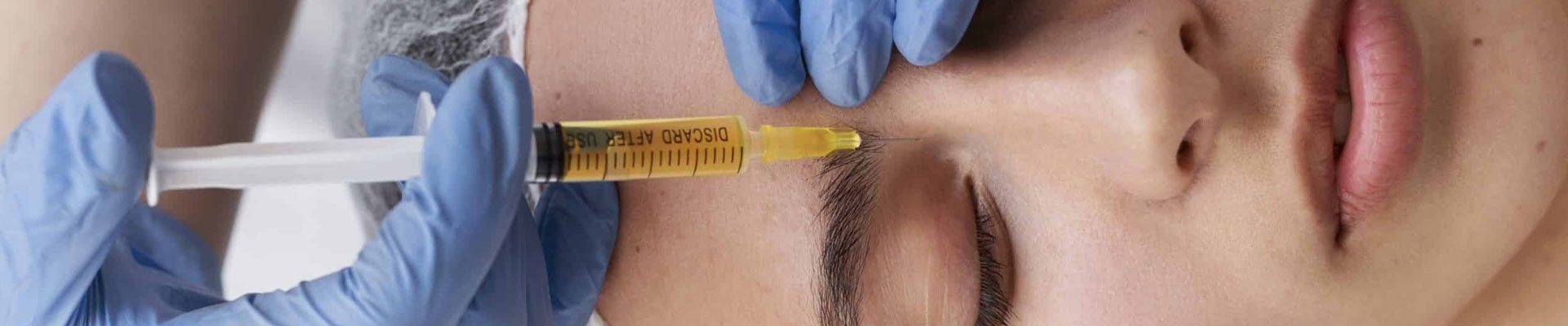 prp-treatment