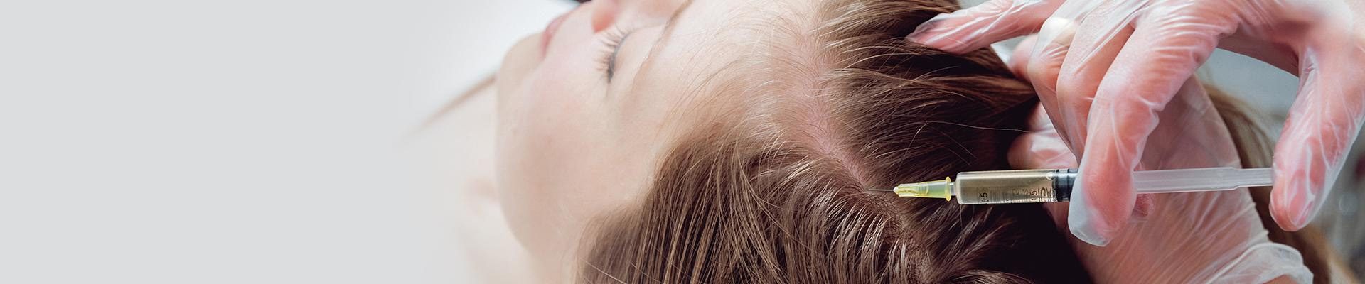stem-cell-hair-transplant