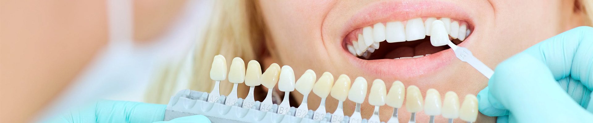 teeth-whitening